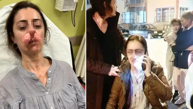 Eşinin Sevgilisi Sanıp Silahla Saldırdı: Otomobil Kapısı Olay Yarattı